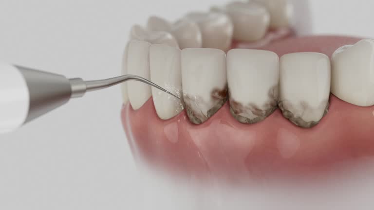 Reliable Dental Implants contractor in Bonny Doon, CA by Smile Center Dentistry